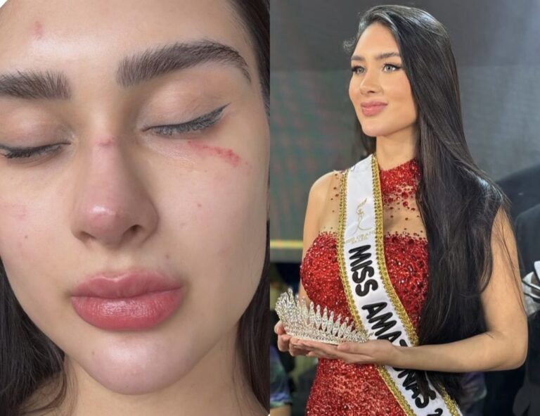 Miss Grand Amazonas, Mariana Barroso, denuncia agressões e ameaça de morte do ex-namorado